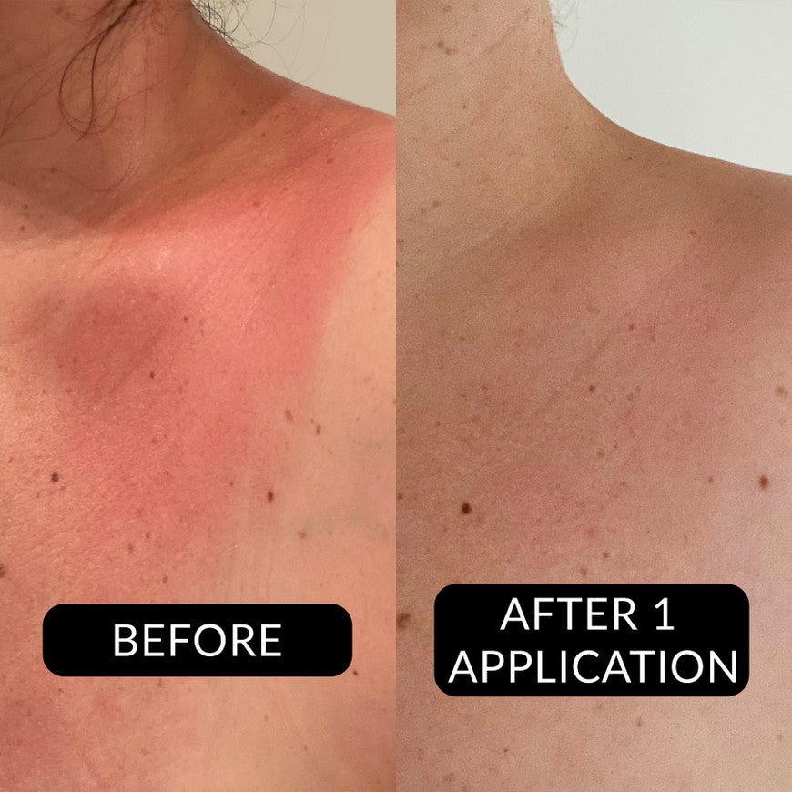 Pevonia After - Sun Soothing Gel - Xceeding Beauty