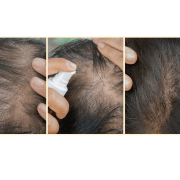 Renew & Boost Microbiome Scalp Treatment - Xceeding Beauty