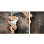 Thinning Hair Serum Set - Xceeding Beauty