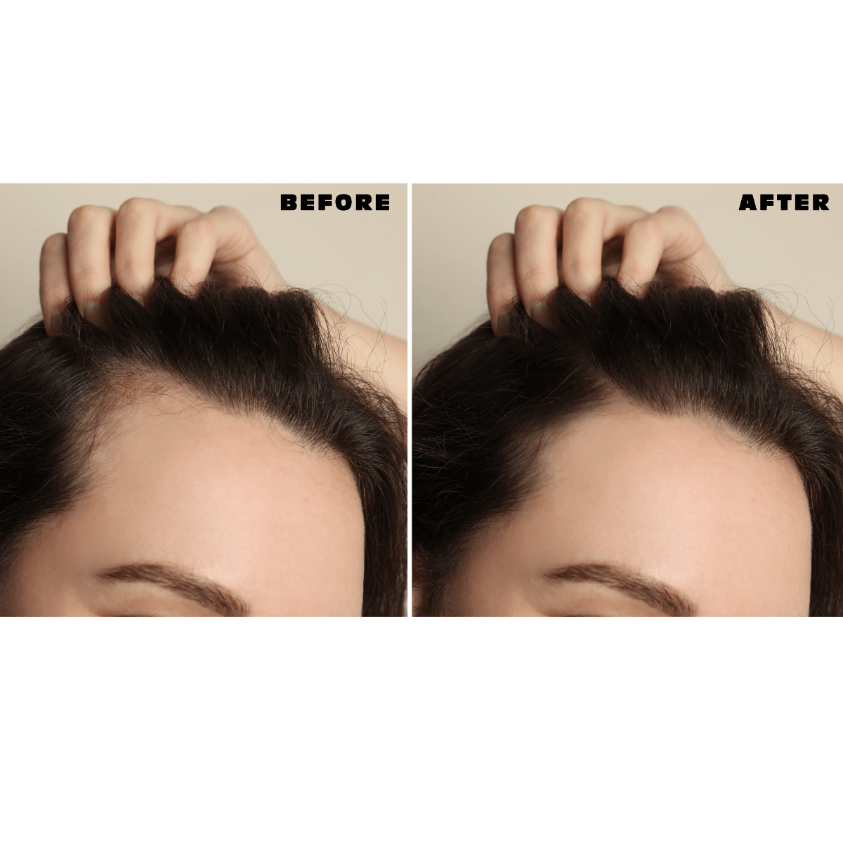 Thinning Hair Serum Set - Xceeding Beauty