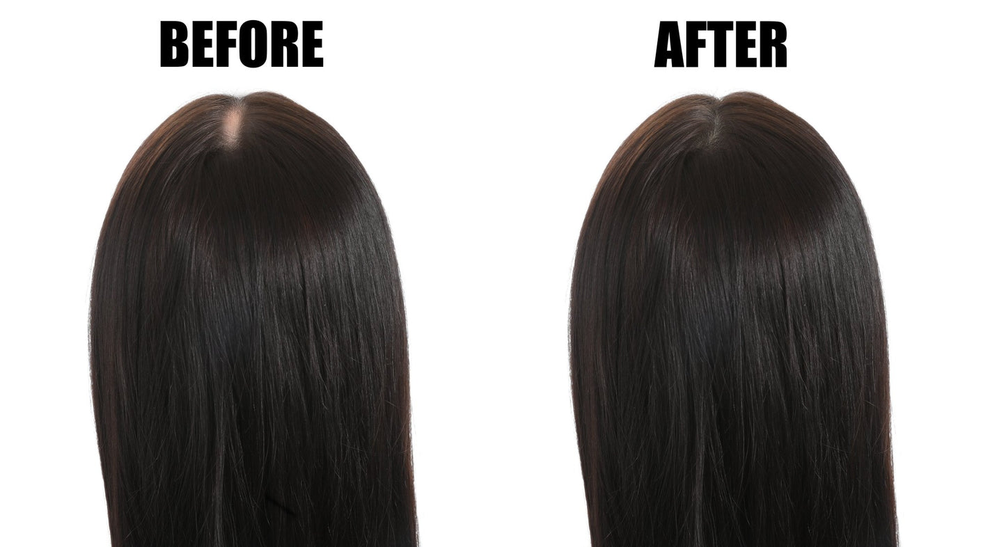 Thinning Hair Serum Set - Xceeding Beauty